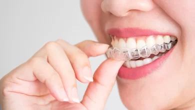 Photo of Invisalign: A Revolutionary Approach To Straightening Teeth
